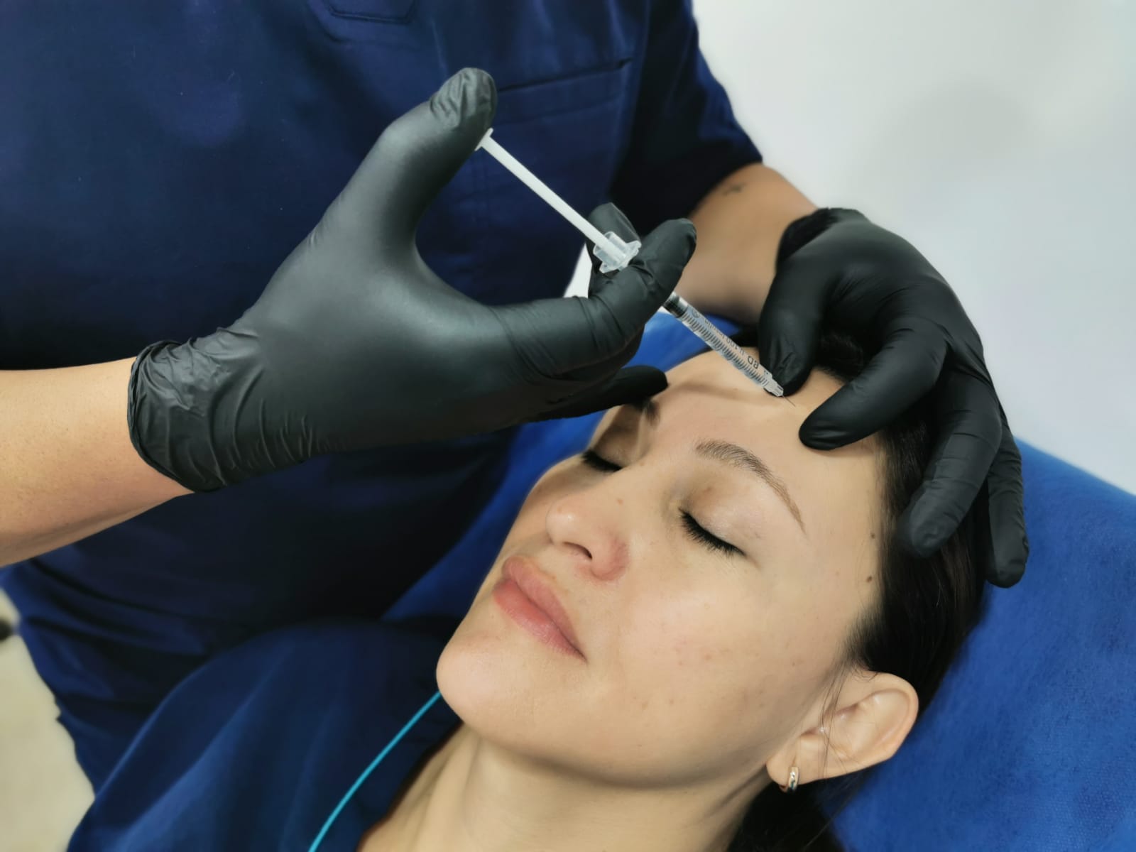 Aplicación toxina botulínica en Medellín